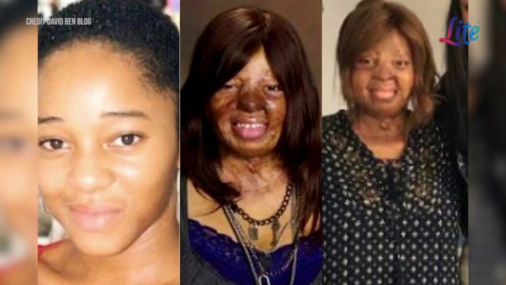 kechi okwuchi before and after plane crash accident